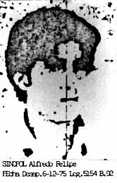 Alfredo Felipe Sinopoli